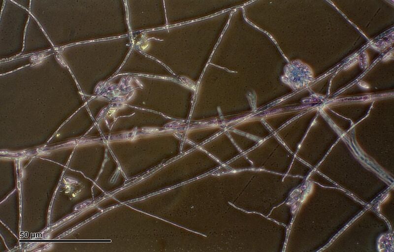 File:Fusarium solani (257 25) Cultured and stained deuteromycetes.jpg