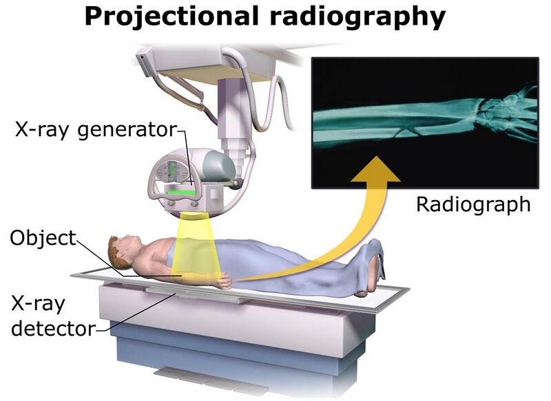 File:Projectional radiography components.jpg