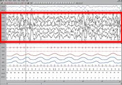 Sleep EEG Stage 4.jpg