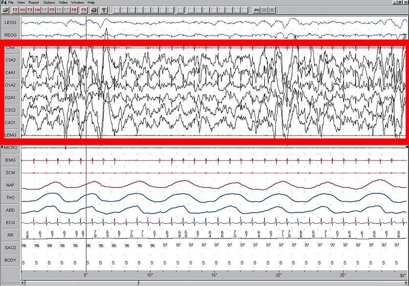 File:Sleep EEG Stage 4.jpg