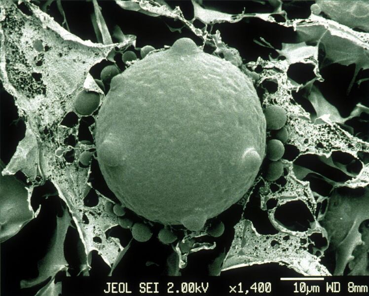 File:CSIRO ScienceImage 1392 Scanning Electron Micrograph of Chytrid Fungus.jpg