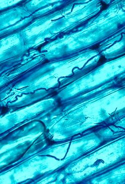 Blue-stained large plant cells with smaller hyphae visible between them