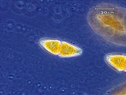 Two-celled teliospore of Gymnosporangium globosum.jpg