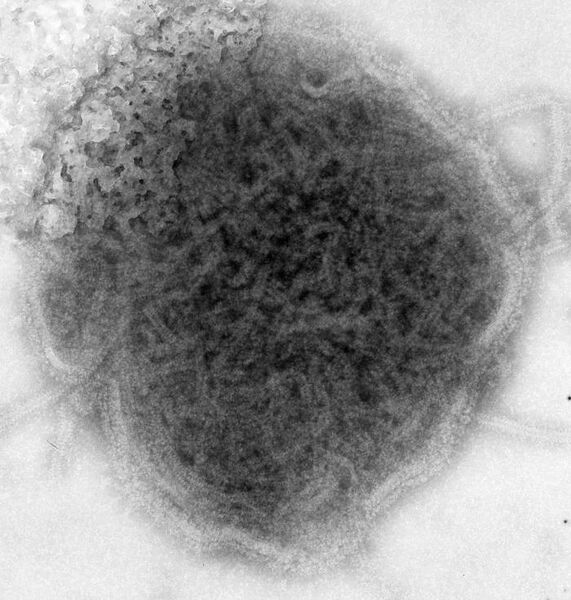 File:Mumps virus, negative stained TEM 8758 lores.jpg