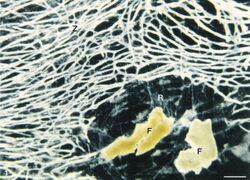Reticulomyxa filosa - Cell body and food particle.jpg
