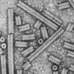 Tobacco Rattles Virus Electron Microscope.jpg