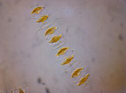 Chaetoceros diadema spores.jpg