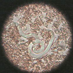 "Dirofilaria immitis" larva, Magnification 400×