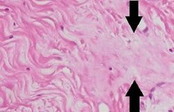 Micrograph of homogenization of collagen.jpg