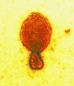 Colored transmission electron micrograph of a "Hendra henipavirus" virion (ca. 300 nm length)