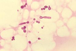 Malassezia furfur in skin scale from a patient with tinea versicolor PHIL 3938 lores.jpg