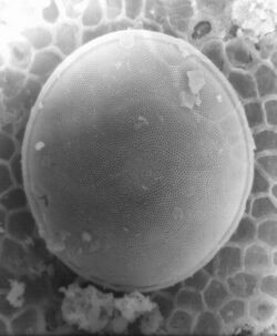 Centric diatom (3075277530).jpg