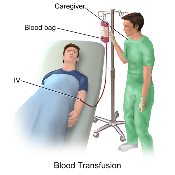 File:Blausen 0087 Blood Transfusion.png