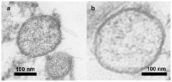 Exosomas vesículas Cardiomiocito.png