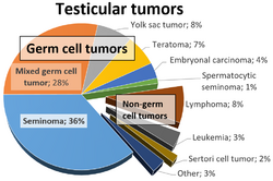 Relative incidences of testicular tumors.png