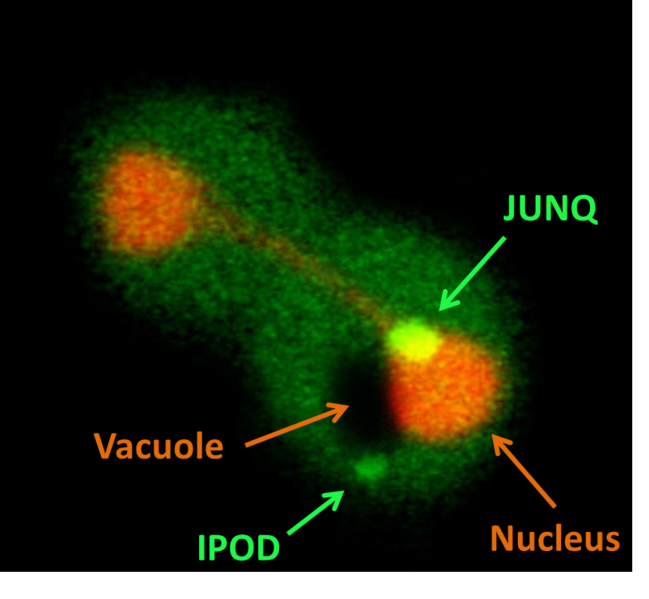 File:A cell harboring JUNQ and IPOD inclusions.png