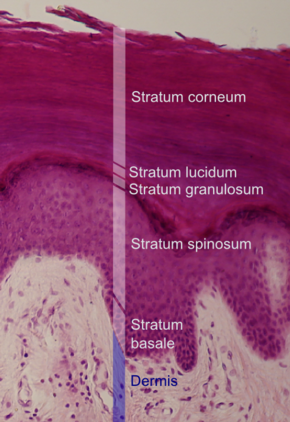 Epidermal layers.png