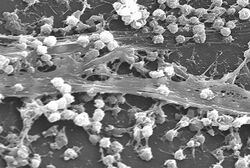 Staphylococcus aureus biofilm 01.jpg
