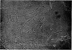 Blastomyces dermatitidis.jpg