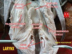 Epiglotic cartilage.jpg