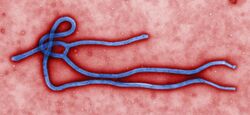 Ebola virus virion.jpg