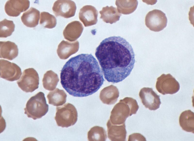 File:Monocytes, a type of white blood cell (Giemsa stained).jpg