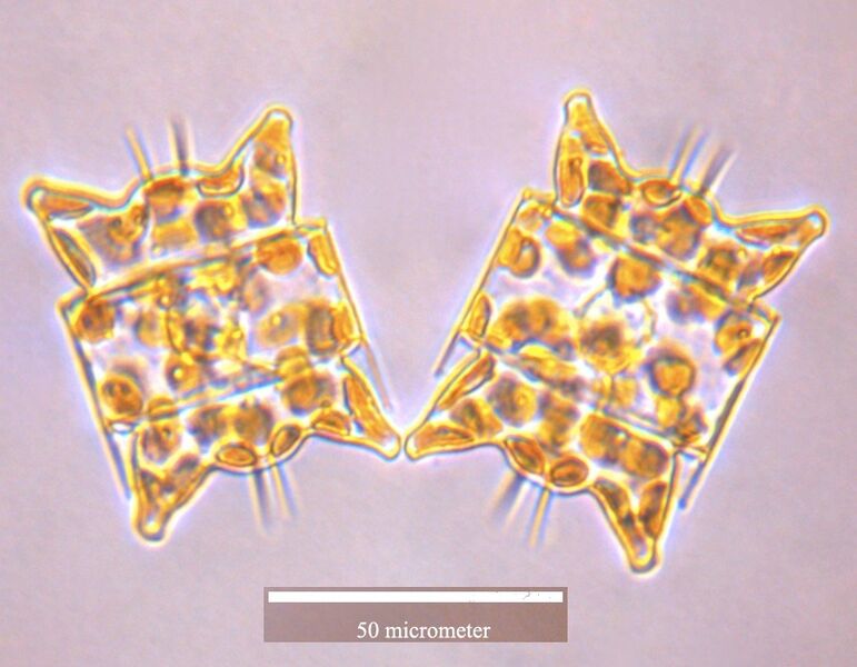 File:Odontella aurita cells.jpg