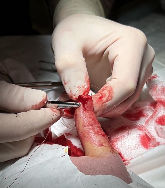 File:A Surgeon Applying a Suture.jpg
