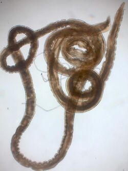 Gongylonema pulchrum nematode from man Figure 2a.jpg