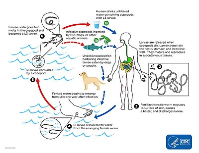 See "Cause" section for description of the worm's life cycle