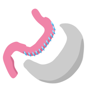 Gastric sleeve icon.svg