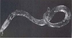 Oesophagostomum larva (micrograph).jpg