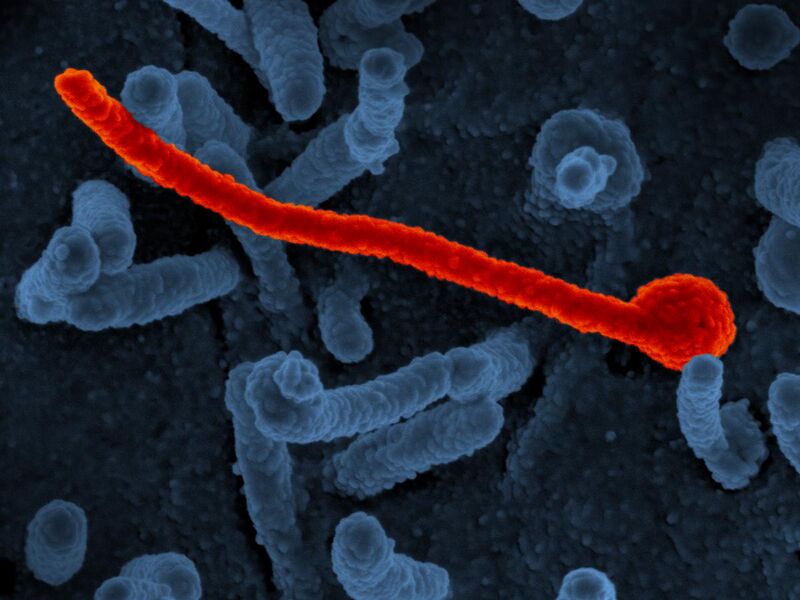 File:Ebola virus Makona from West African Epidemic (43234028254).jpg