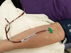 Plasmapheresis line full.jpg