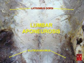 Lumbar aponeurosis.jpg