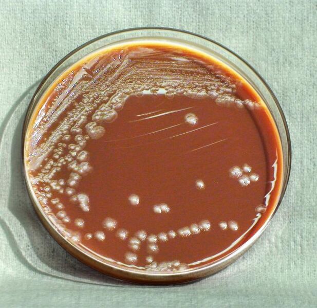 File:Yersinia pestis HHS.jpg