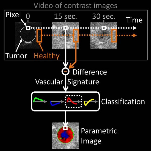 File:Parametric Imaging of Vascular Signatures.jpg
