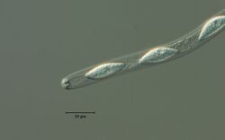 Annulatscus velatisporus ascus and apical ring