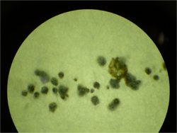 pycnidia of "Diplodia hederae" growing on a potato dextrose agar plate