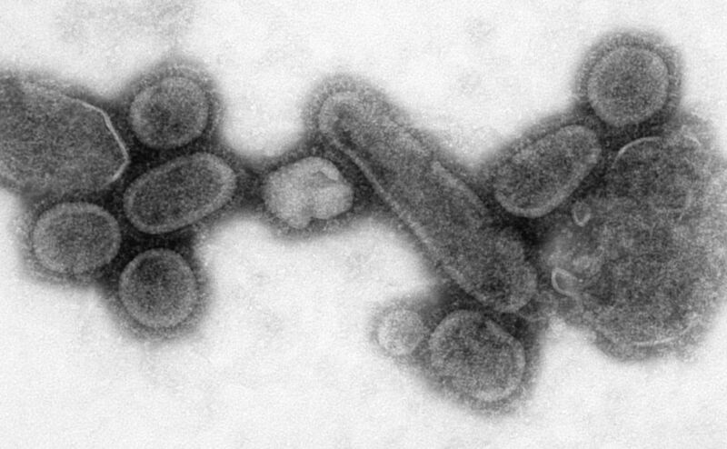 File:Reconstructed Spanish Flu Virus.jpg