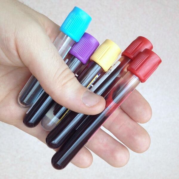 File:Vacutainer blood bottles.jpg