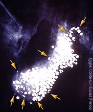 An X-ray picture with numerous small pellets highlighted in white