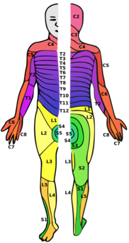 A person with dermatomes mapped out on the skin