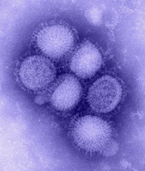 File:H1N1 influenza virus.jpg
