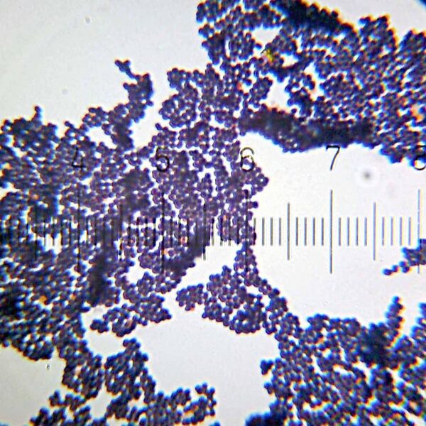 File:20101017 231210 Staphylococcus.jpg