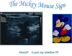 Mickey mouse sign.png