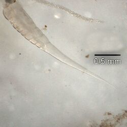 Pinworms (U.S.)/Threadworms (U.K.) ("Enterobius vermicularis")