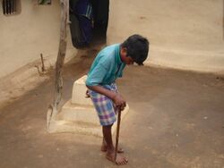 Fluorosis in Chhattisgarh.jpg