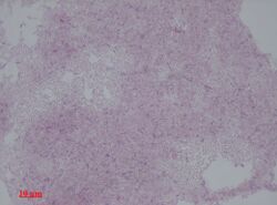 Methylobacterium (Gram stain).jpg