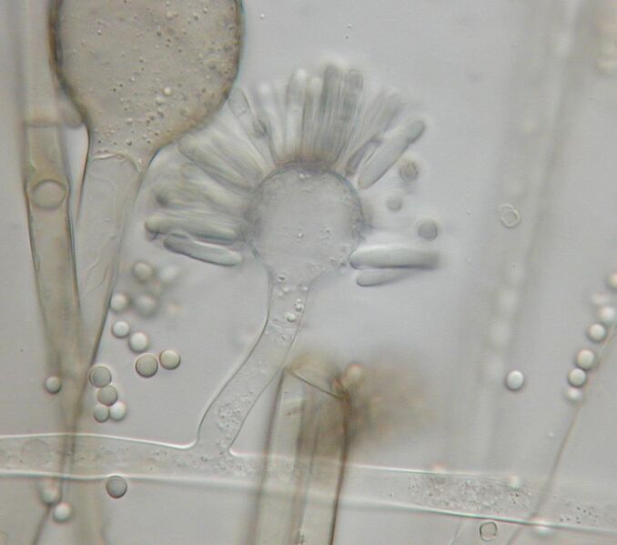 File:Syncephalastrum racemosum sporangiophores.jpg